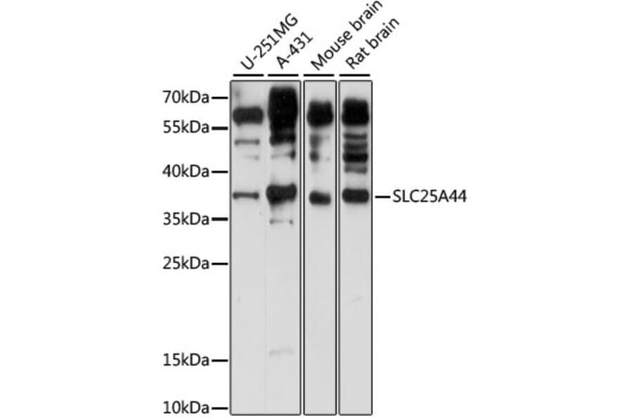 Western Blot - Anti-SLC25A44 Antibody (A89499) - Antibodies.com