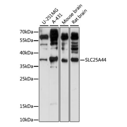 Western Blot - Anti-SLC25A44 Antibody (A89499) - Antibodies.com