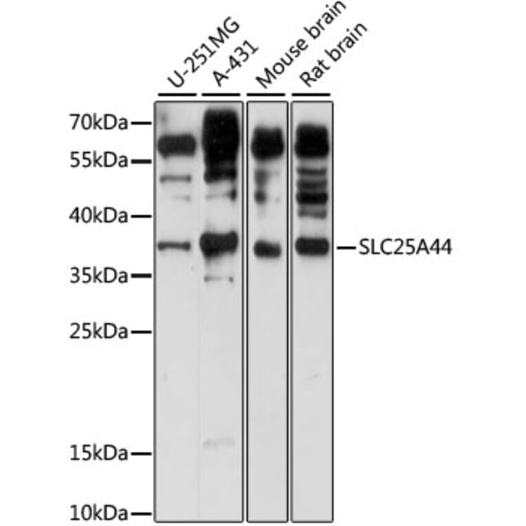 Western Blot - Anti-SLC25A44 Antibody (A89499) - Antibodies.com