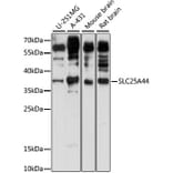 Western Blot - Anti-SLC25A44 Antibody (A89499) - Antibodies.com