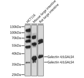 Western Blot - Anti-GAL4 Antibody (A89500) - Antibodies.com