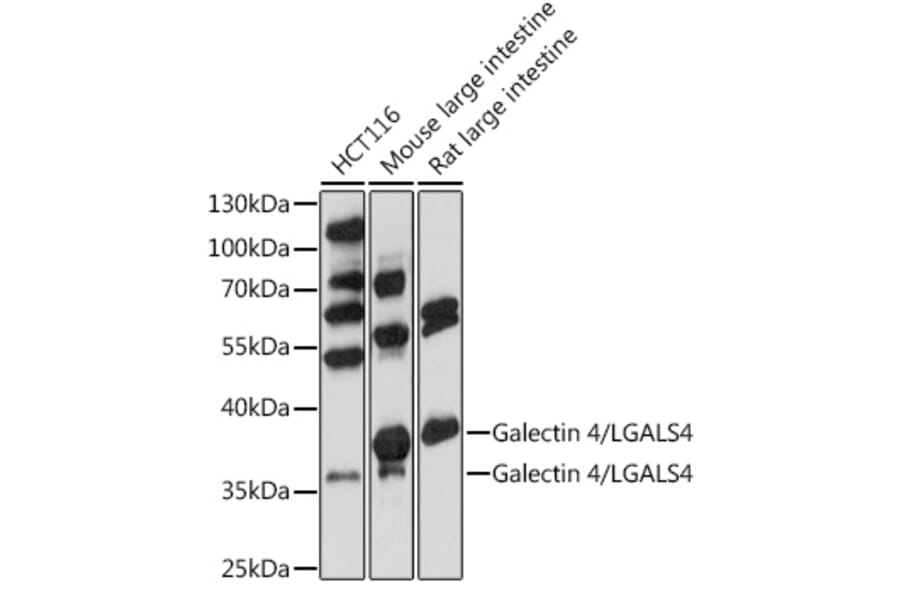 Western Blot - Anti-GAL4 Antibody (A89500) - Antibodies.com