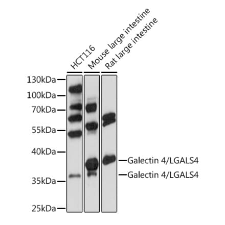 Western Blot - Anti-GAL4 Antibody (A89500) - Antibodies.com