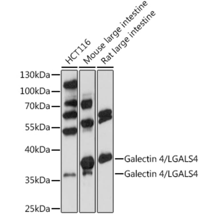 Western Blot - Anti-GAL4 Antibody (A89500) - Antibodies.com