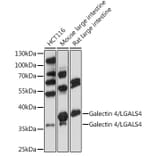 Western Blot - Anti-GAL4 Antibody (A89500) - Antibodies.com