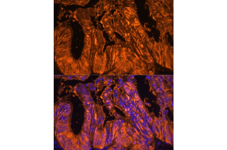 Immunofluorescence - Anti-GAL4 Antibody (A89500) - Antibodies.com