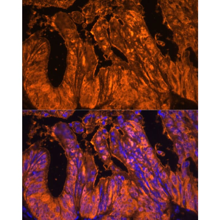 Immunofluorescence - Anti-GAL4 Antibody (A89500) - Antibodies.com