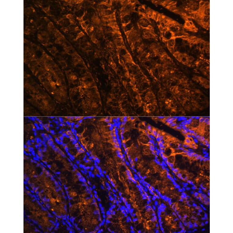 Immunofluorescence - Anti-GAL4 Antibody (A89500) - Antibodies.com