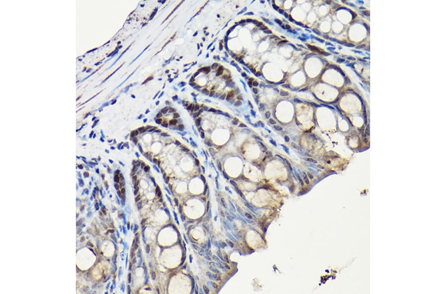Immunohistochemistry - Anti-PCNA Antibody (A89501) - Antibodies.com