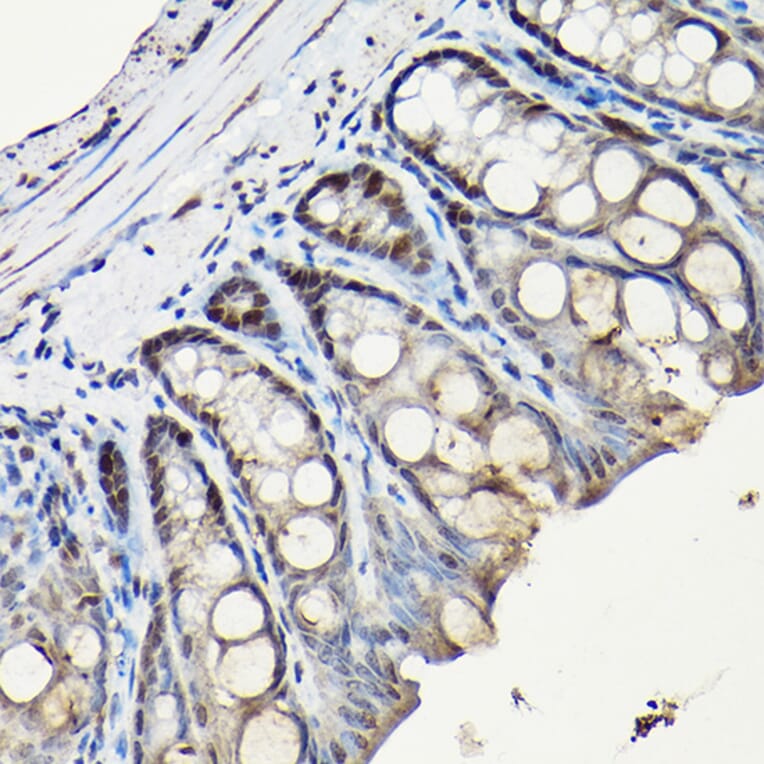 Immunohistochemistry - Anti-PCNA Antibody (A89501) - Antibodies.com