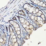 Immunohistochemistry - Anti-PCNA Antibody (A89501) - Antibodies.com