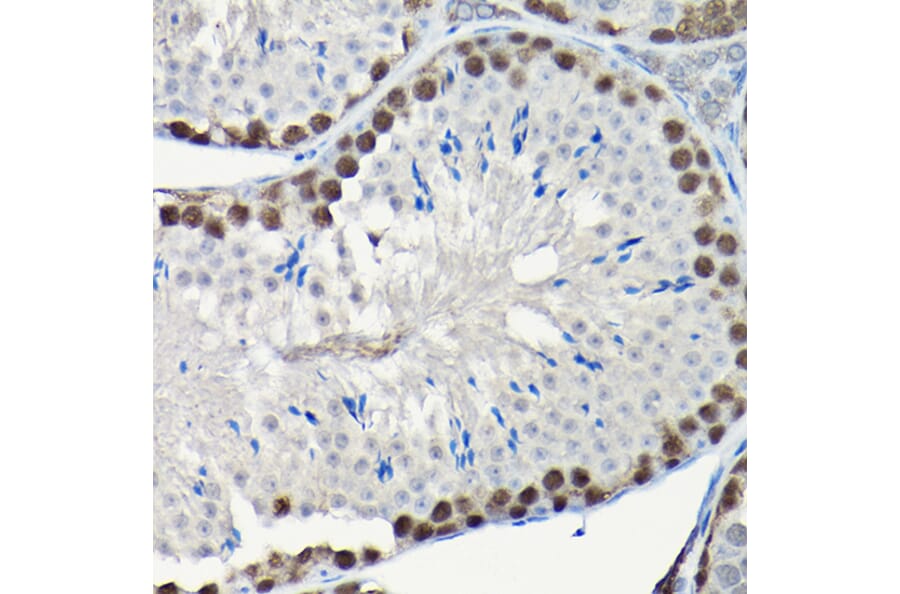 Immunohistochemistry - Anti-PCNA Antibody (A89501) - Antibodies.com
