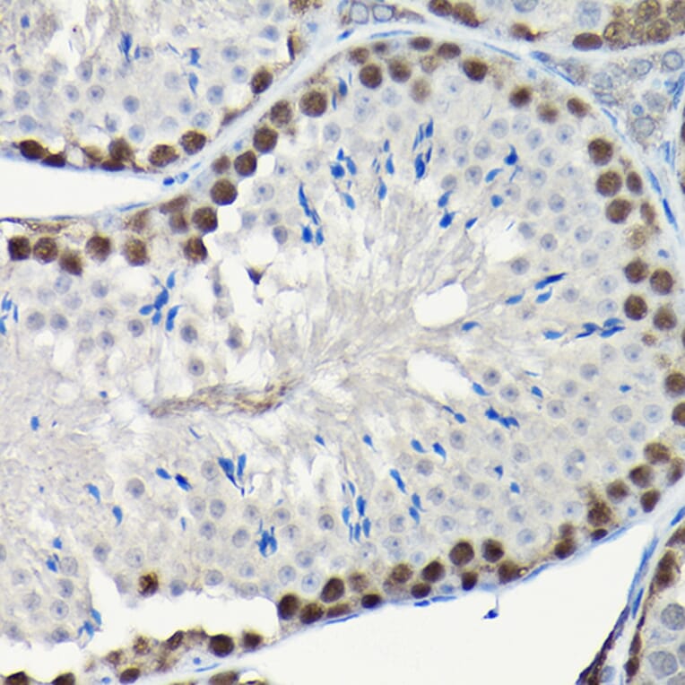 Immunohistochemistry - Anti-PCNA Antibody (A89501) - Antibodies.com
