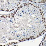Immunohistochemistry - Anti-PCNA Antibody (A89501) - Antibodies.com