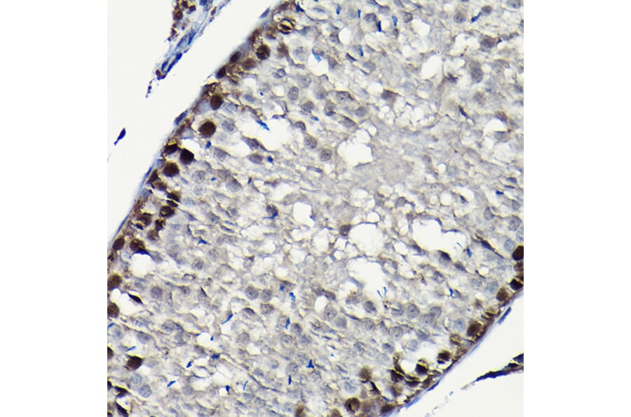 Immunohistochemistry - Anti-PCNA Antibody (A89501) - Antibodies.com