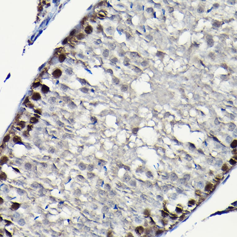 Immunohistochemistry - Anti-PCNA Antibody (A89501) - Antibodies.com