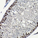 Immunohistochemistry - Anti-PCNA Antibody (A89501) - Antibodies.com