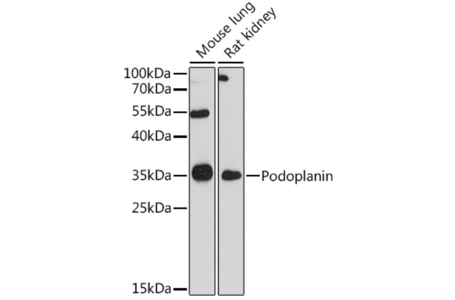 Western Blot - Anti-Podoplanin/gp36 Antibody (A89502) - Antibodies.com