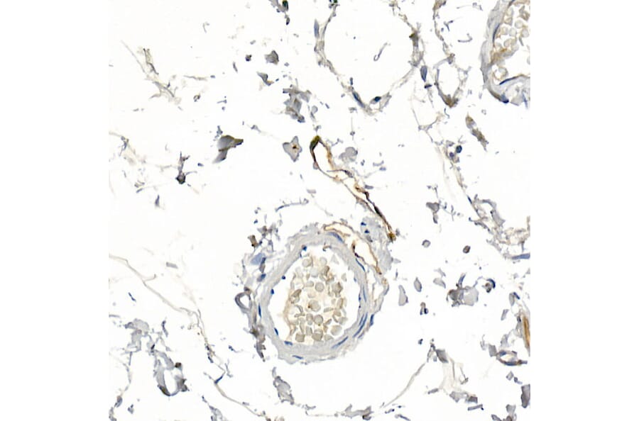 Immunohistochemistry - Anti-Podoplanin/gp36 Antibody (A89502) - Antibodies.com