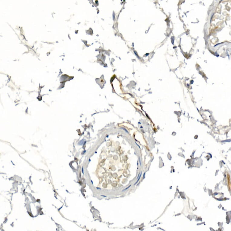 Immunohistochemistry - Anti-Podoplanin/gp36 Antibody (A89502) - Antibodies.com