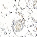 Immunohistochemistry - Anti-Podoplanin/gp36 Antibody (A89502) - Antibodies.com