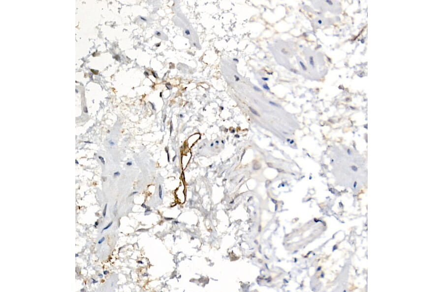 Immunohistochemistry - Anti-Podoplanin/gp36 Antibody (A89502) - Antibodies.com