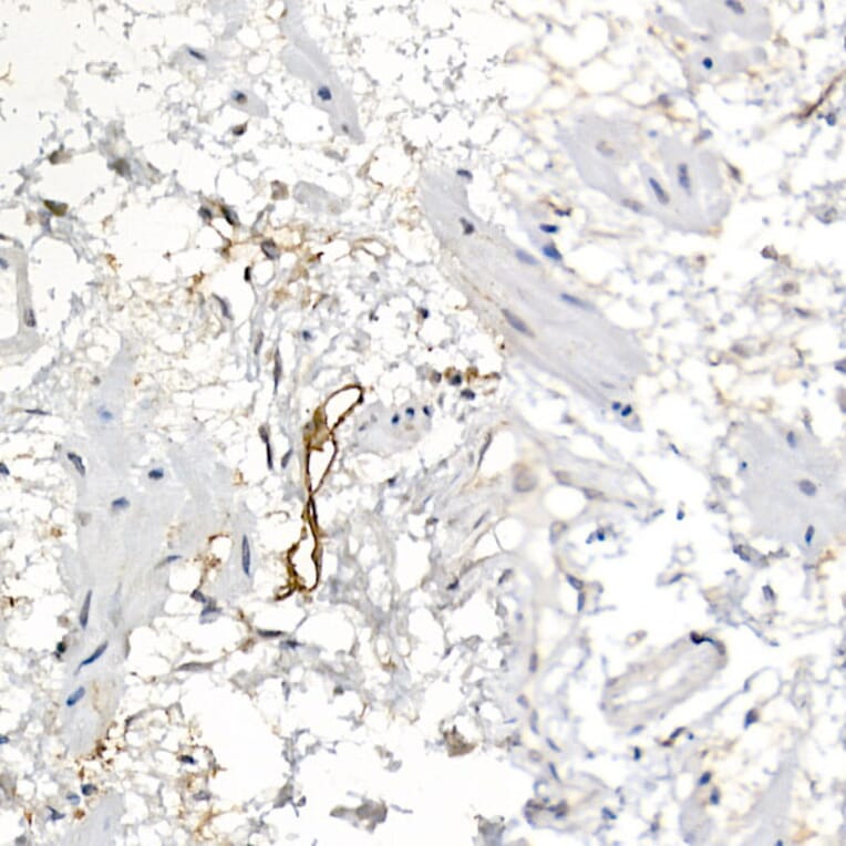 Immunohistochemistry - Anti-Podoplanin/gp36 Antibody (A89502) - Antibodies.com
