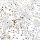 Immunohistochemistry - Anti-Podoplanin/gp36 Antibody (A89502) - Antibodies.com