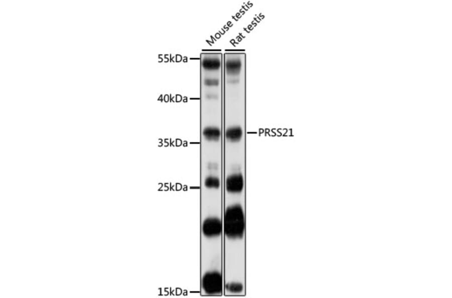 Western Blot - Anti-PRSS21/ESP1 Antibody (A89503) - Antibodies.com