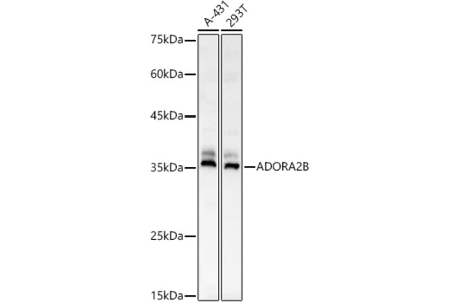 Western Blot - Anti-Adenosine A2b Receptor/ADORA2B Antibody (A89504) - Antibodies.com