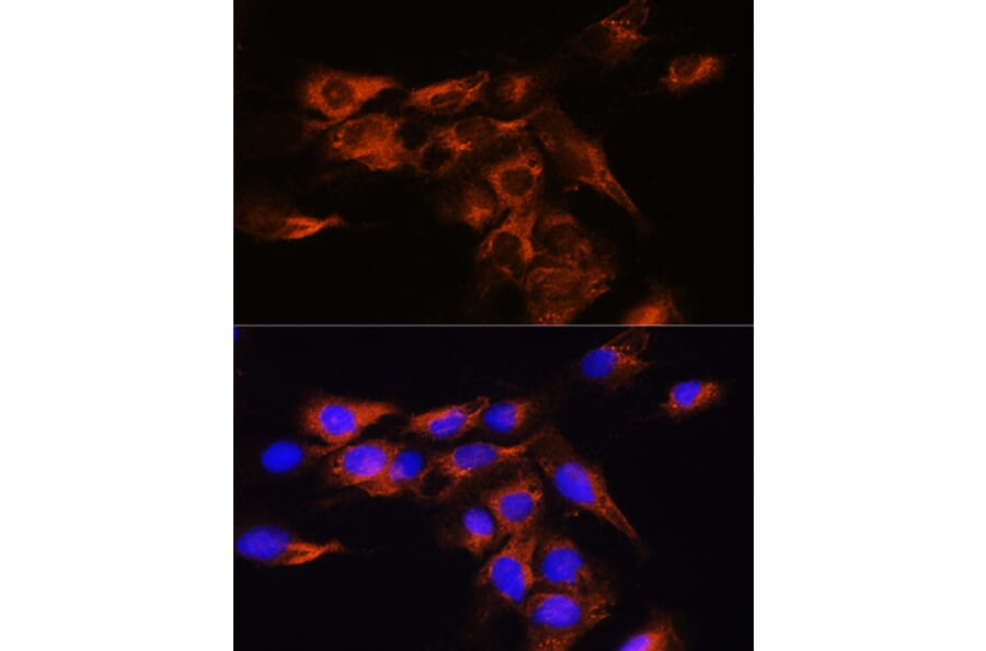 Immunofluorescence - Anti-Adenosine A2b Receptor/ADORA2B Antibody (A89504) - Antibodies.com