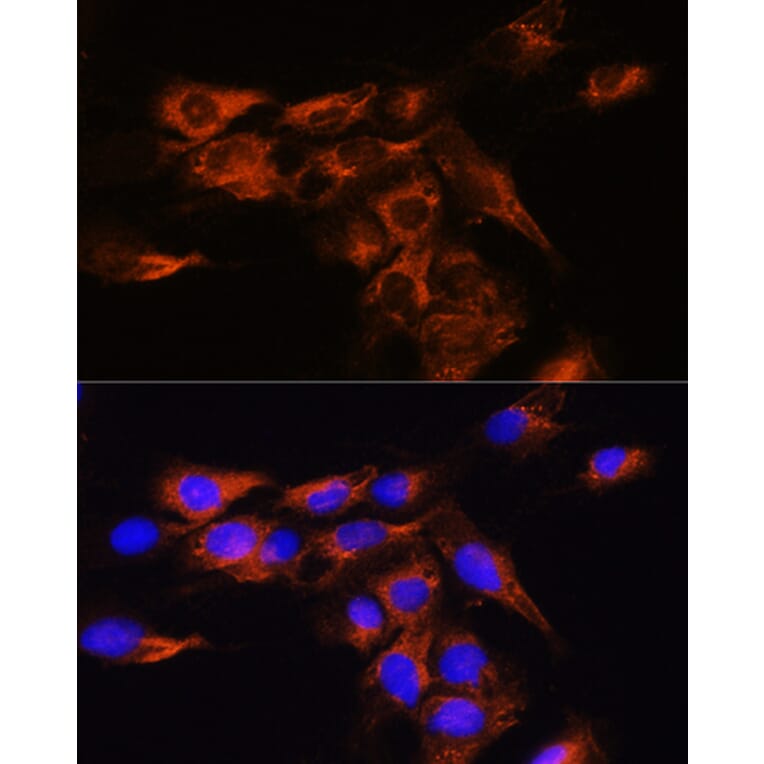 Immunofluorescence - Anti-Adenosine A2b Receptor/ADORA2B Antibody (A89504) - Antibodies.com
