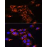 Immunofluorescence - Anti-Adenosine A2b Receptor/ADORA2B Antibody (A89504) - Antibodies.com