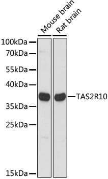 Western blot analysis of extracts of various cell lines, using Anti-TAS2R10 Antibody (A15156) at 1:1,000 dilution.
Secondary antibody: Goat Anti-Rabbit IgG (H+L) (HRP) (AS014) at 1:10,000 dilution.
Lysates / proteins: 25µg per lane.
Blocking buffer: 3% non-fat dry milk in TBST.
Detection: ECL Basic Kit (RM00020).
Exposure time: 5s.