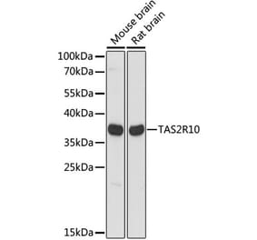 Western Blot - Anti-TAS2R10 Antibody (A89505) - Antibodies.com
