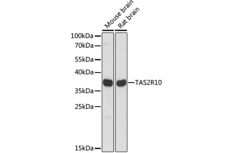 Western Blot - Anti-TAS2R10 Antibody (A89505) - Antibodies.com
