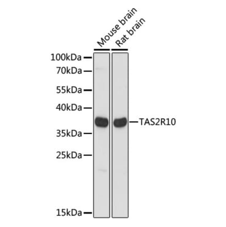 Western Blot - Anti-TAS2R10 Antibody (A89505) - Antibodies.com