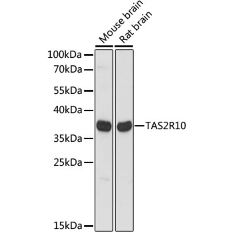 Western Blot - Anti-TAS2R10 Antibody (A89505) - Antibodies.com