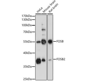 Western Blot - Anti-Fos B Antibody (A89506) - Antibodies.com