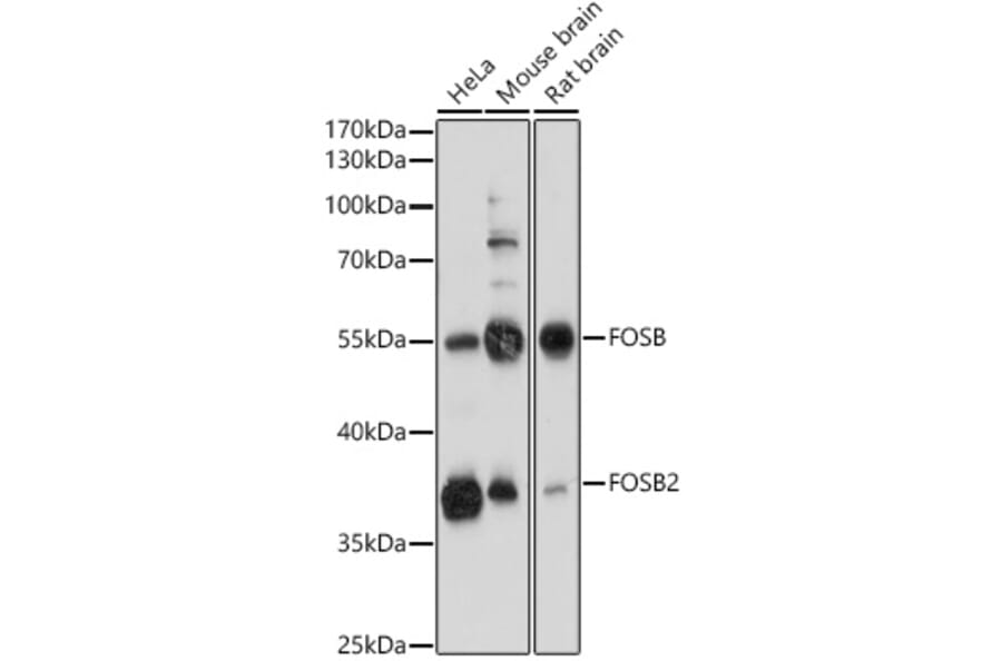 Western Blot - Anti-Fos B Antibody (A89506) - Antibodies.com