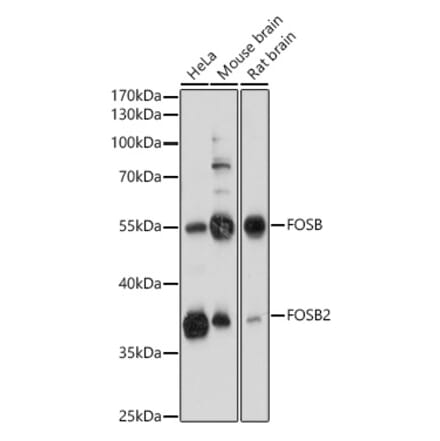 Western Blot - Anti-Fos B Antibody (A89506) - Antibodies.com