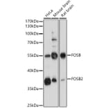 Western Blot - Anti-Fos B Antibody (A89506) - Antibodies.com