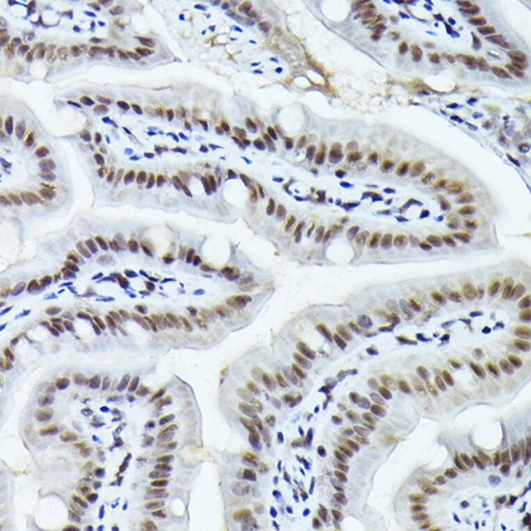 Immunohistochemistry - Anti-Fos B Antibody (A89506) - Antibodies.com