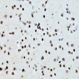 Immunohistochemistry - Anti-Fos B Antibody (A89506) - Antibodies.com