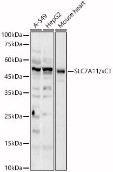 Western blot analysis of extracts of various cell lines, using Anti-SLC7A11 Antibody (A13685) at 1:1,000 dilution.
Secondary antibody: Goat Anti-Rabbit IgG (H+L) (HRP) (AS014) at 1:10,000 dilution.
Lysates / proteins: 25µg per lane.
Blocking buffer: 3% non-fat dry milk in TBST.
Detection: ECL Basic Kit (RM00020).
Exposure time: 30s.