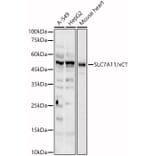 Western Blot - Anti-xCT Antibody (A89508) - Antibodies.com