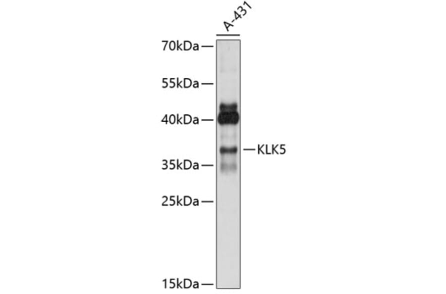Western Blot - Anti-Kallikrein 5 Antibody (A89509) - Antibodies.com