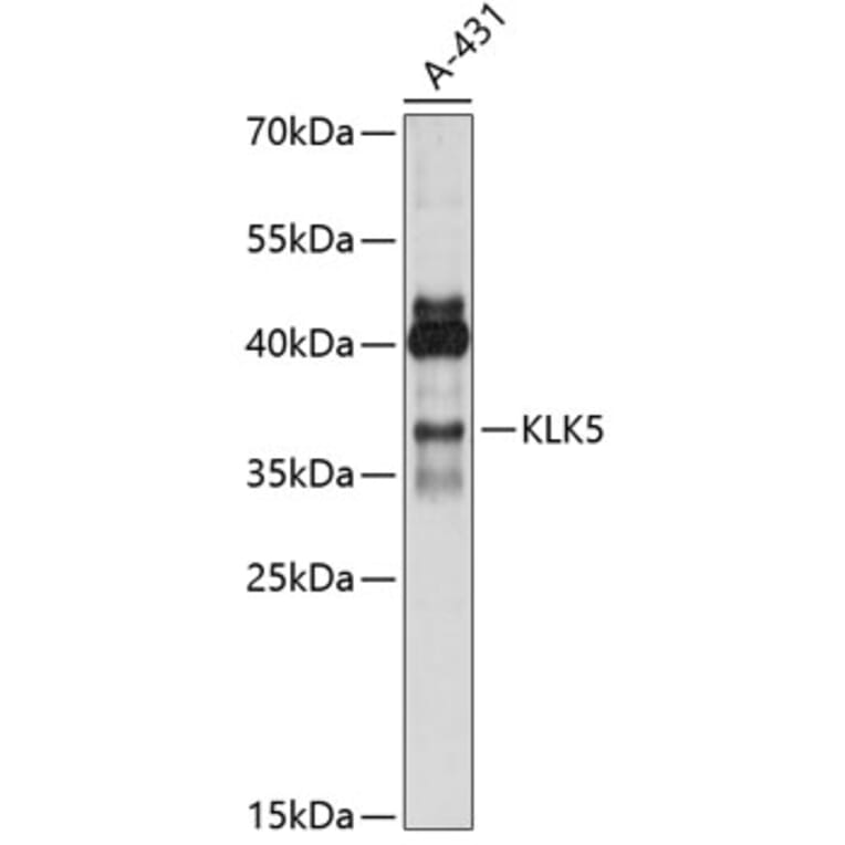 Western Blot - Anti-Kallikrein 5 Antibody (A89509) - Antibodies.com
