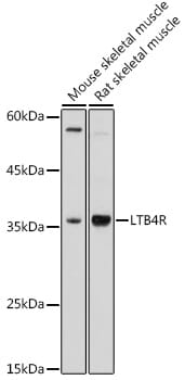 Western blot analysis of extracts of Mouse thymus, using Anti-LTB4R Antibody (A15042) at 1:1,000 dilution.
Secondary antibody: Goat Anti-Rabbit IgG (H+L) (HRP) (AS014) at 1:10,000 dilution.
Lysates / proteins: 25µg per lane.
Blocking buffer: 3% non-fat dry milk in TBST.
Detection: ECL Basic Kit (RM00020).
Exposure time: 30s.