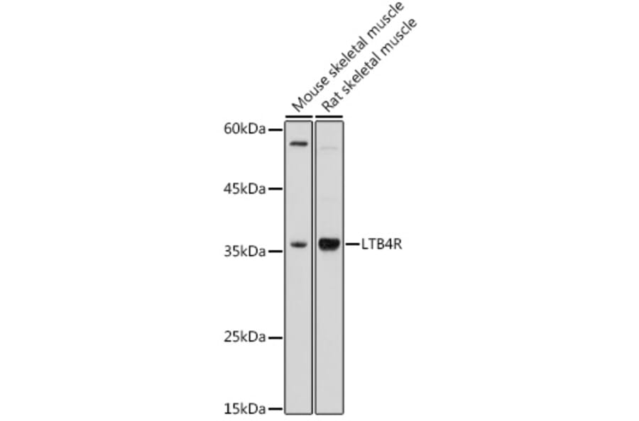 Western Blot - Anti-Leukotriene B4 Receptor/BLT Antibody (A89510) - Antibodies.com